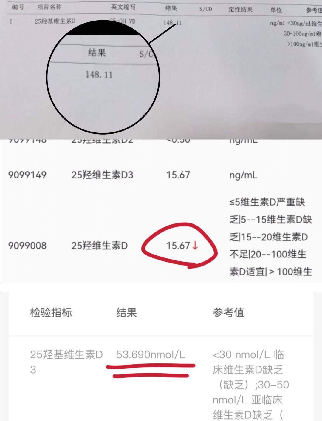 糖尿病补充 2 种维生素，病情会慢慢好