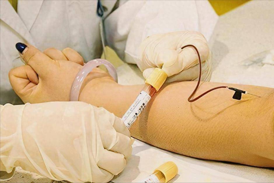 “升脂大户”找到了，劝告：想要血脂正常，就尽量少吃这6种东西