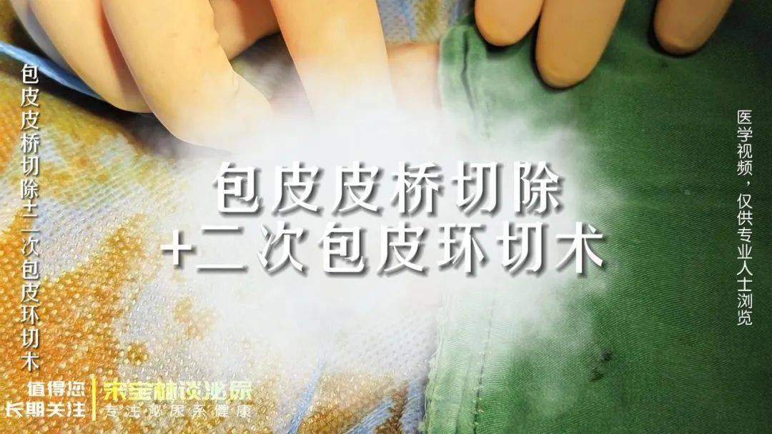 083手术视频｜包皮皮桥切除术+二次包皮环切术