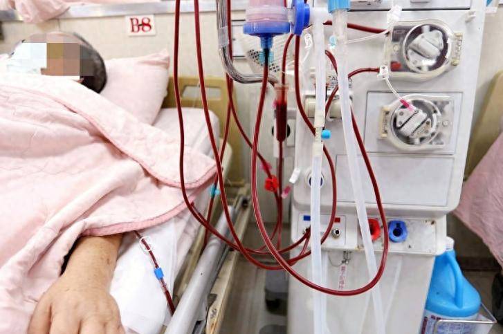 透析头痛——让您头痛了吗?