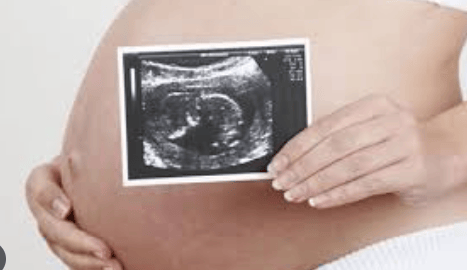孕初期做B超会影响胎儿吗？真相揭晓！