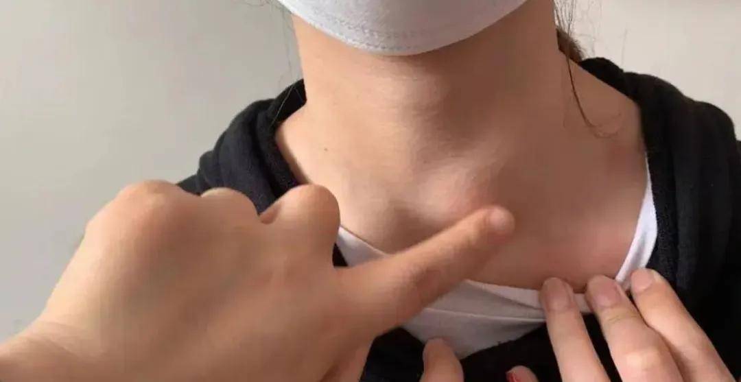 该如何去预防甲状腺癌，这三点不能缺少！