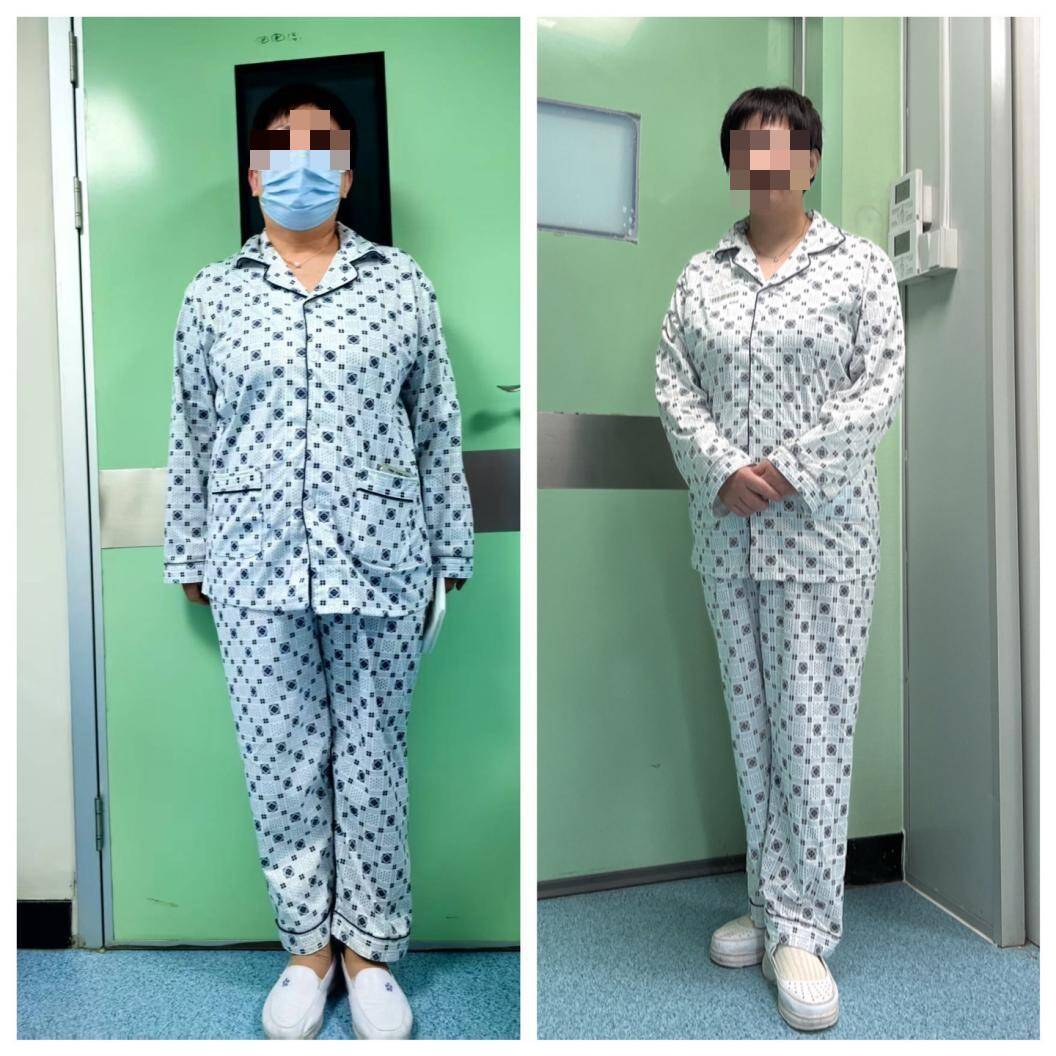 3个月减重34斤！山东省第二人民医院成功实施胃转流支架置入术