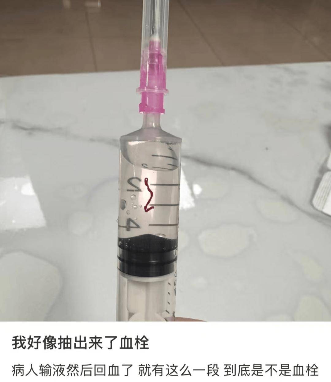 输液时抽出“虾线”状血条！？我还有救吗……