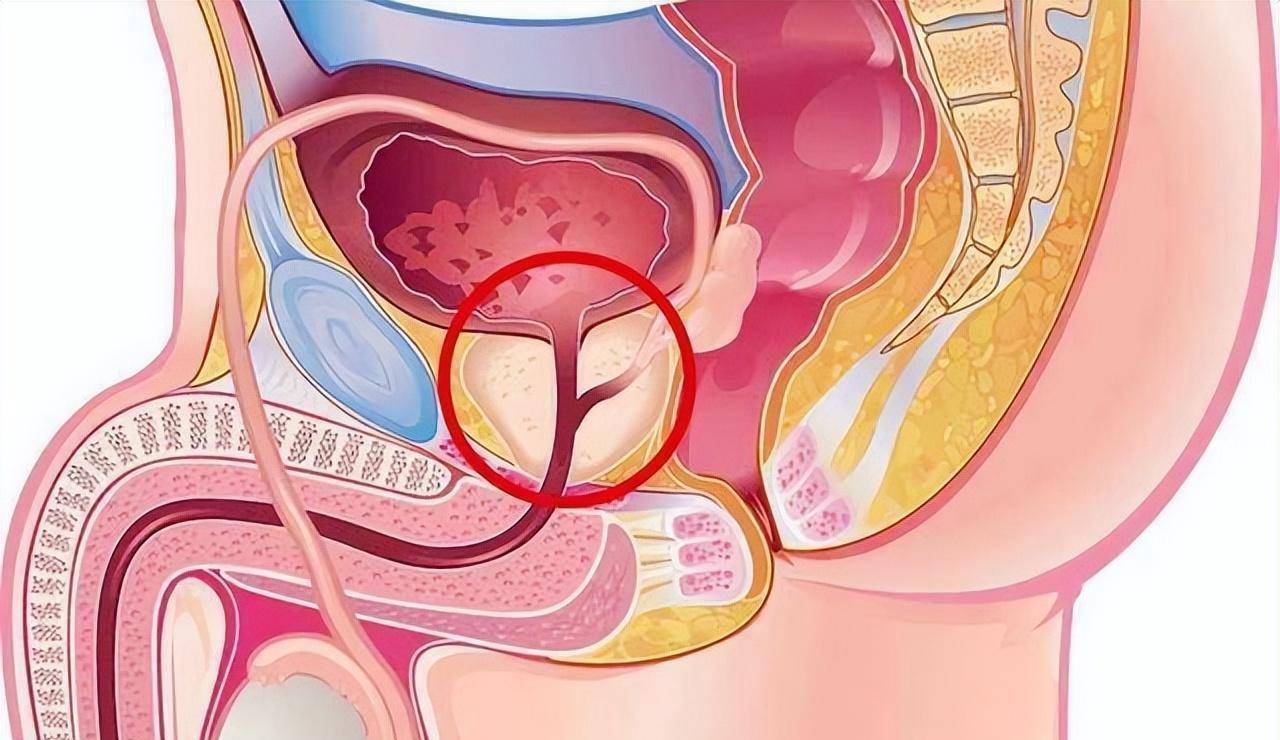 阴茎癌能自愈吗？张涵英主任医师提醒【别被侥幸心理耽误治疗】！