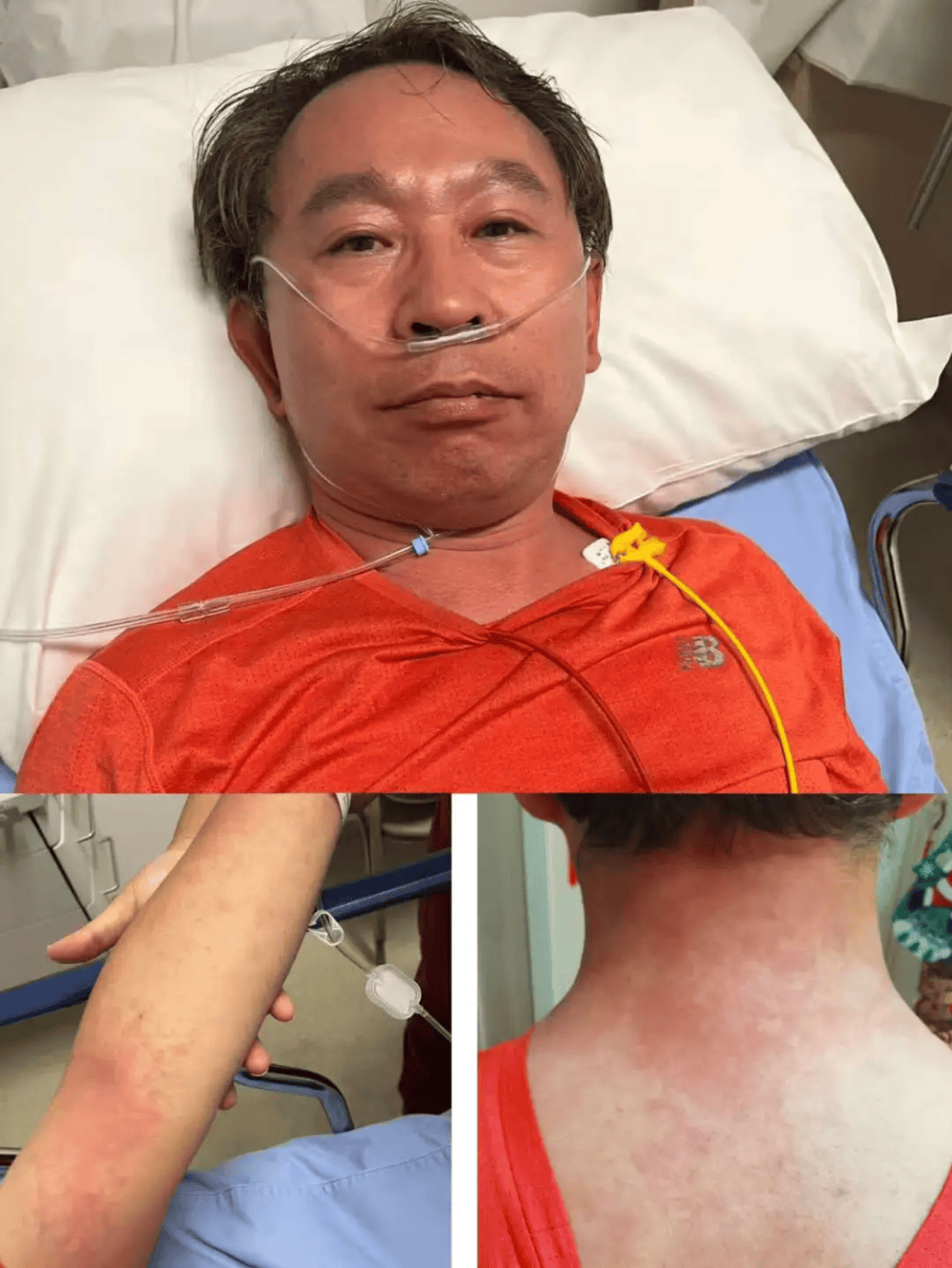 882 ▏医生吃头孢遇险，“一不小心成为反面教材”，紧急提醒→