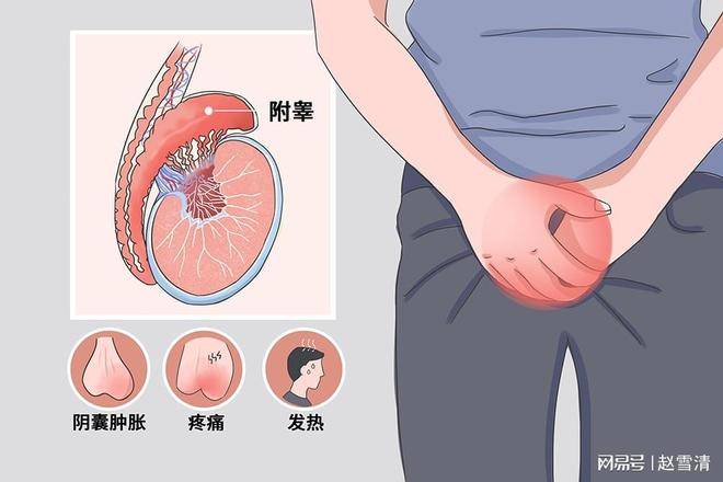 分类汇总：慢性附睾炎常用中药方剂有哪些