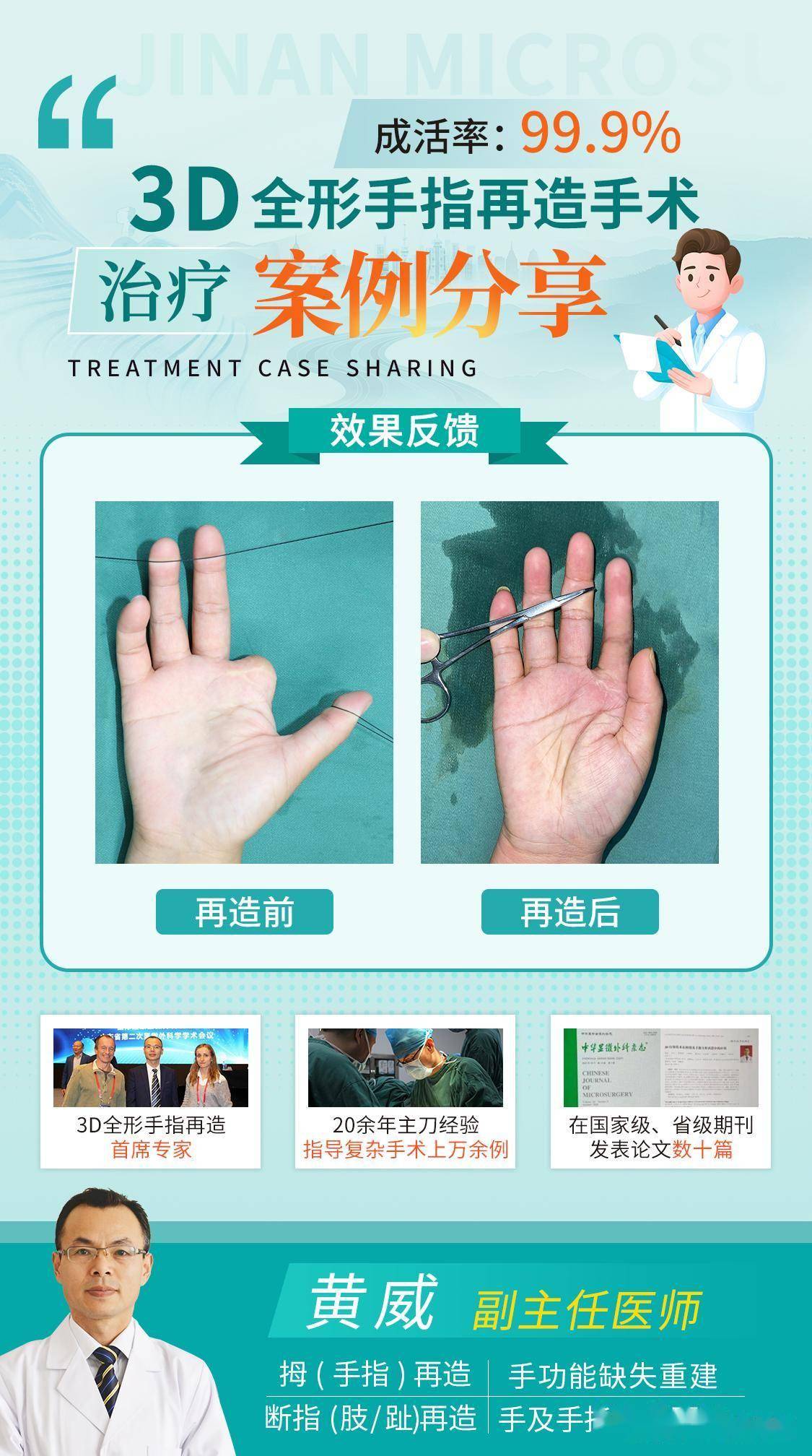 什么是3D全形手指再造？