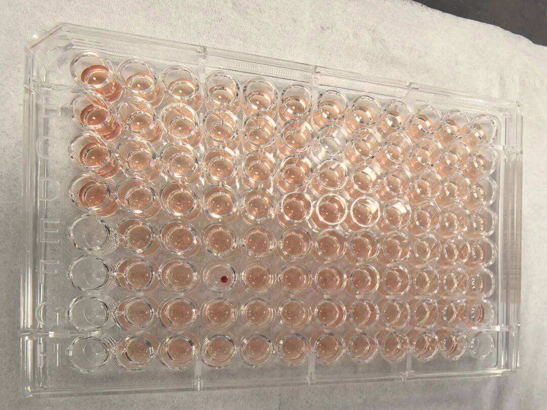 广东发现一例“钻石血”