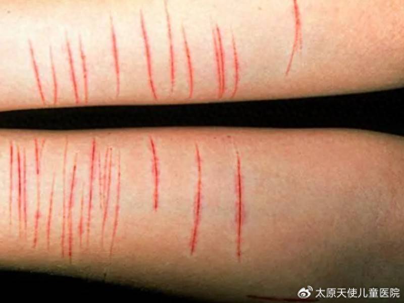 青少年抑郁，正在用3种“伪解压”方式自我毁灭，家长必须制止！