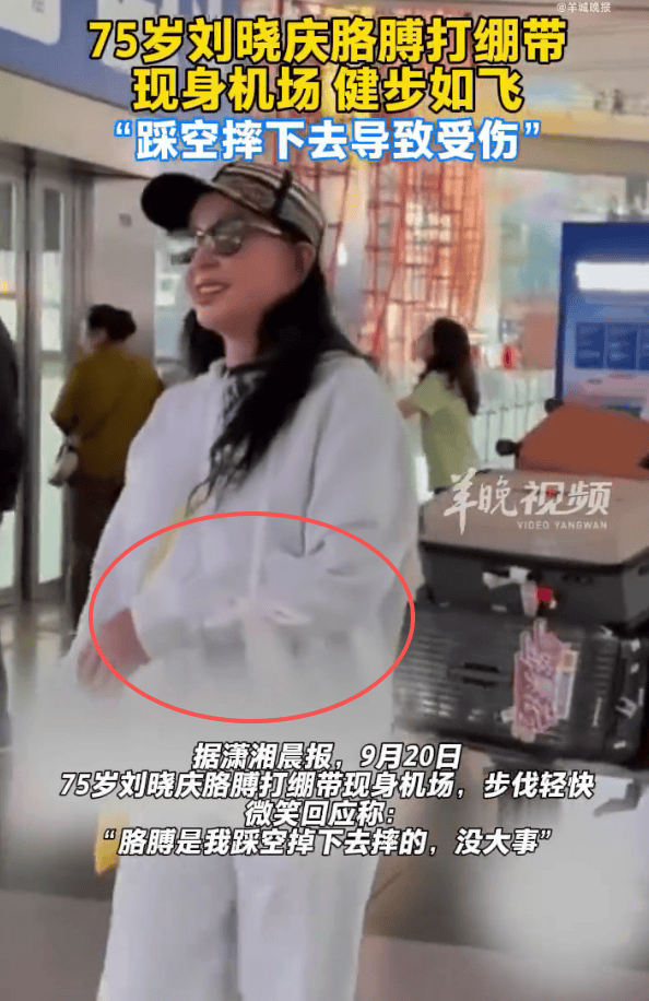 75岁刘晓庆回应胳膊受伤：是我踩空掉下去摔的，没大事