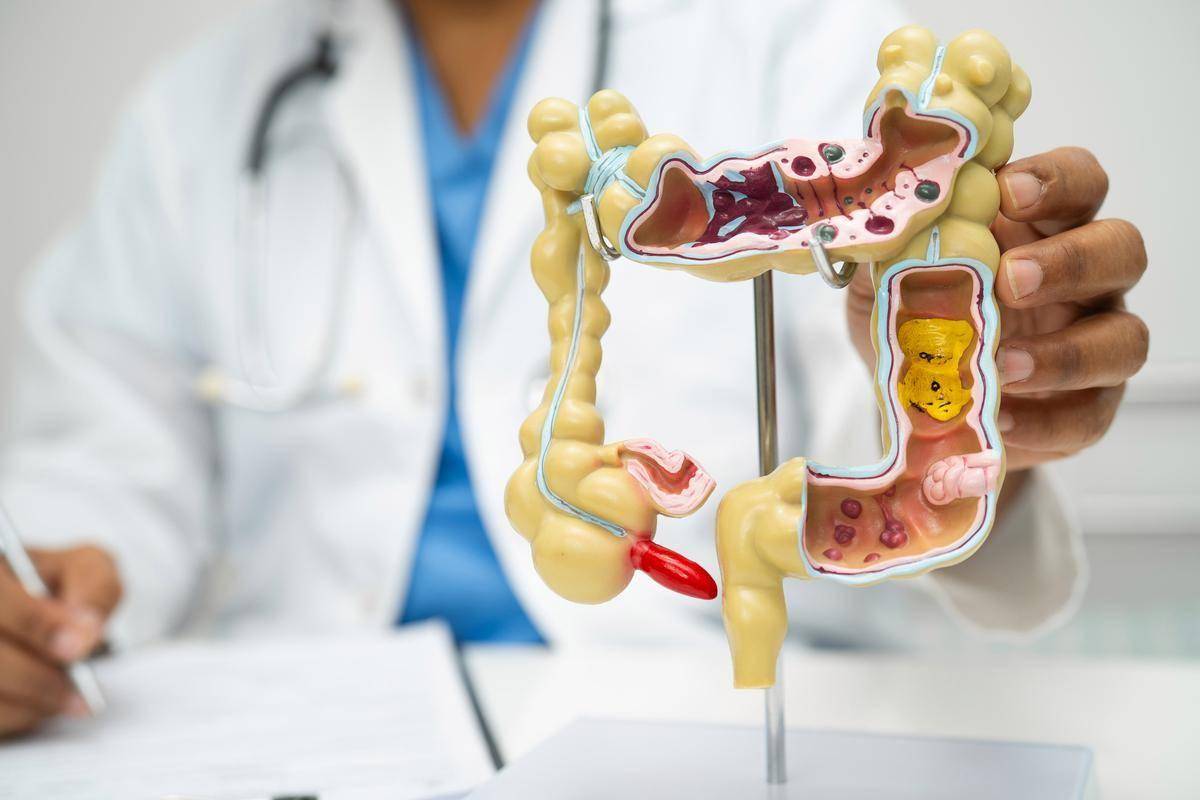 原创            22岁小伙每天腹泻8次查出肠癌：那些被误判的“肠胃小毛病”背后藏着致命危机