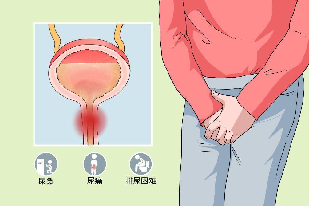 告别灼痛与尴尬：全方位守护您的尿道健康——尿道炎预防攻略