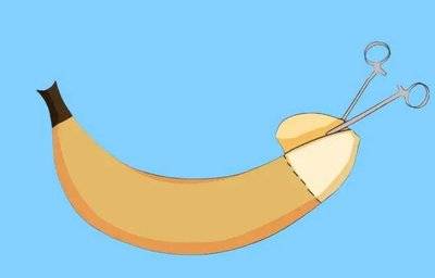 什么是包皮？包皮健康知识全解析