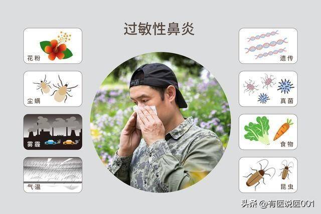 过敏性鼻炎反复鼻塞流涕？10类常用治疗药物，一文总结：对症选用