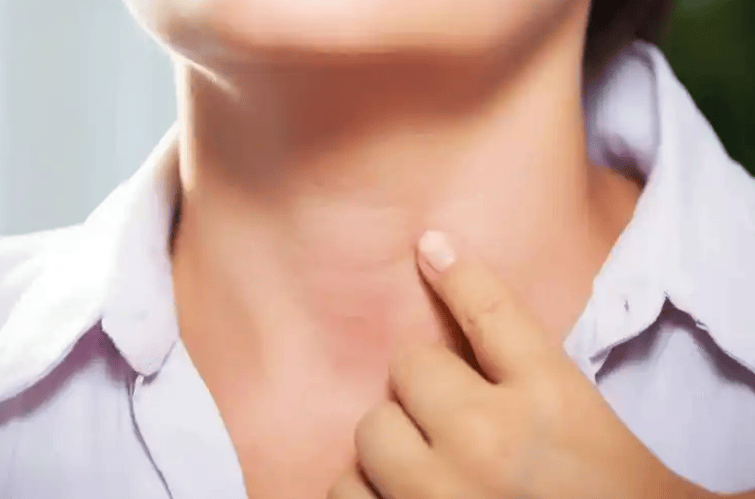 【西安甲康甲状腺研究院】颈部淋巴结肿大：如何判断是否与甲状腺癌相关？