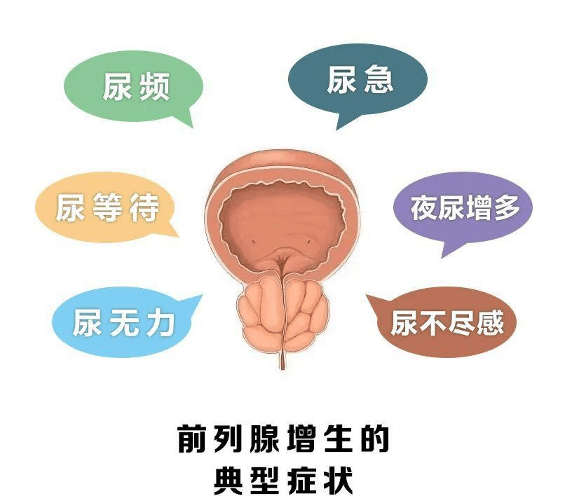 健康科普 | 老年男性如何跨过前列腺增生这道“健康坎”？