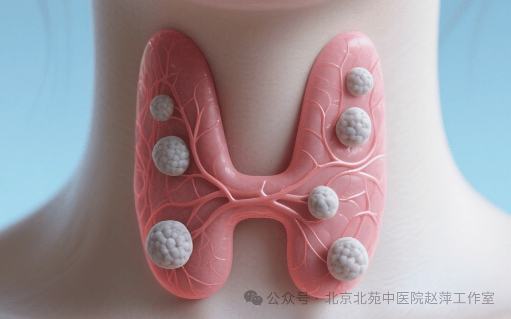 甲状腺结节报告“纵横比＞1”！这是恶性“强烈信号”，原因讲清