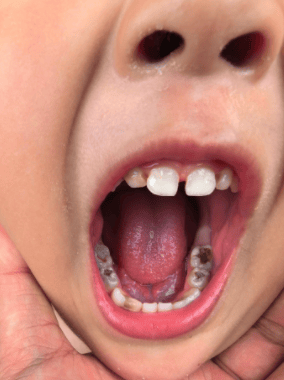 当妈后才懂！娃的口腔、眼睛和早期发育，这些细节真不能马虎