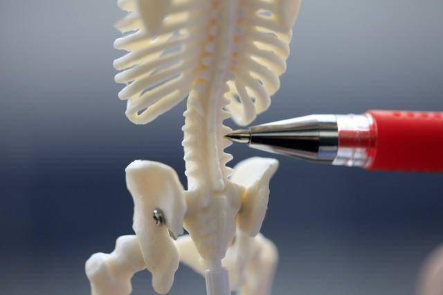 腰椎间盘突出症调理：8类西药5个中成药全解析，科学治疗少走弯路