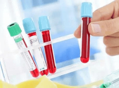 高尿酸成“第四高”！沉默杀手背后的健康危机与科学防治