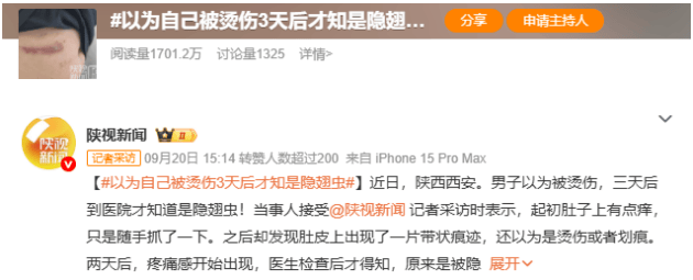 警惕“飞行的硫酸”！西安隐翅虫高发期防护指南