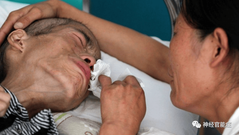 神经症植物神经紊乱全身游走性疼痛，麻木，刺痛怎么治？