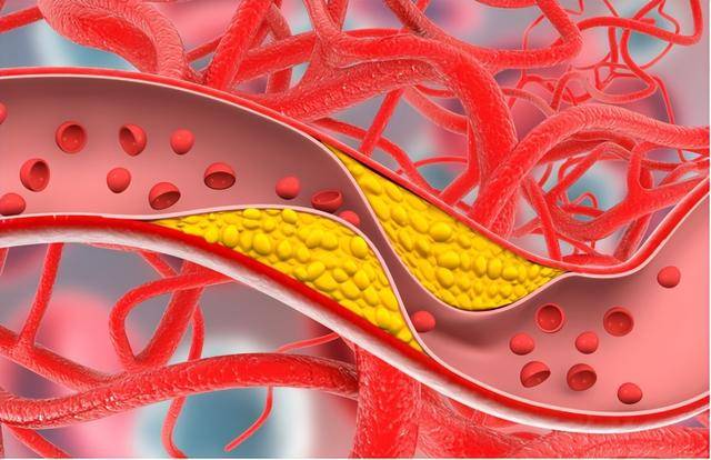 国产他达拉非也分等级，这种国产他达拉非纯度更高