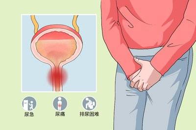 男性分泌物异常？别羞于查看！这可能是身体的“健康警报”