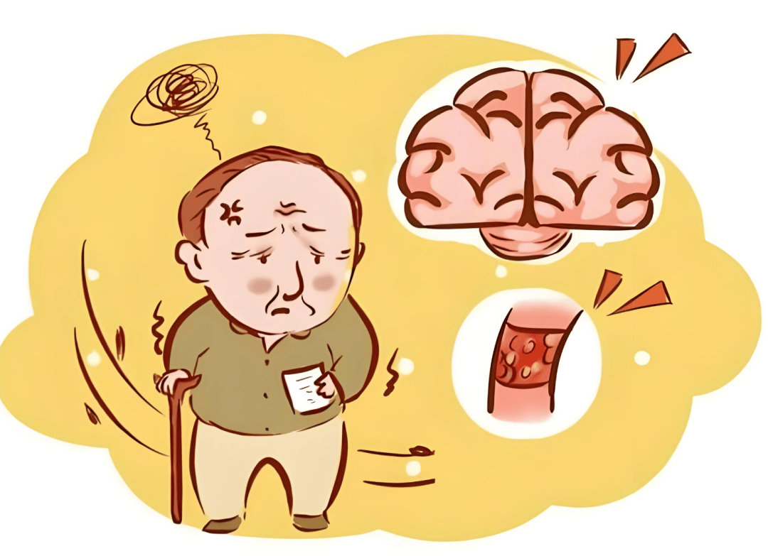 【汤医科普】心脑血管疾病：健康的隐形杀手，你了解多少？