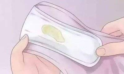 白带发黄与健康的微妙关系，你知道几个？