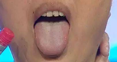 健脾祛湿最厉害的一个穴位，99%的人不知道