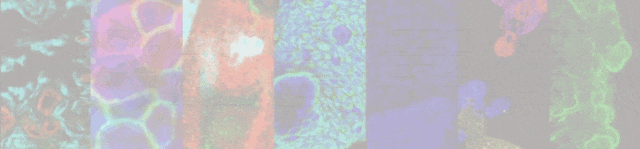 华工刘佳团队：白藜芦醇联合化疗精准杀耐药肺癌类器官