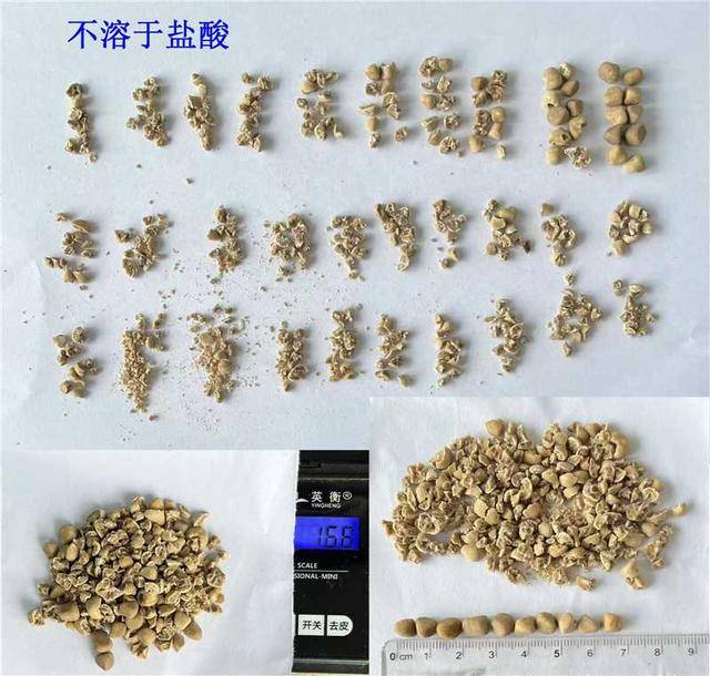 40多枚结石的负担！深圳医生为七旬教授重启顺畅人生