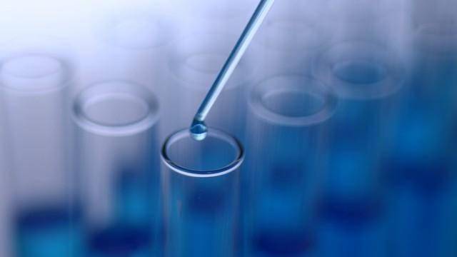 尿蛋白偏高别忽视？8个中成药：辨证调理，辅助保护肾功能