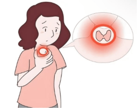 B超显示：甲状腺弥漫性病变！了解它之后就不怕了