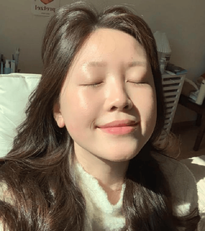 湿疹折磨到绝望，现皮肤光滑如初，我逆袭成功！