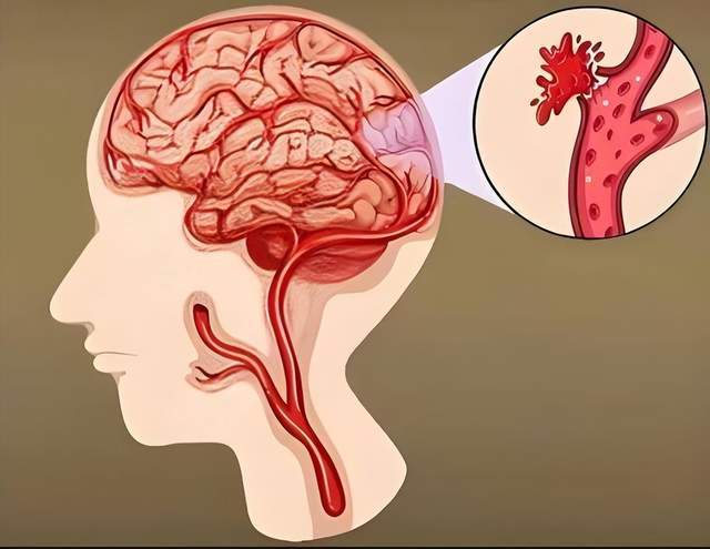 原创            平均每12秒，就有一人因心脑血管疾病倒下！6类高危人群做好预防