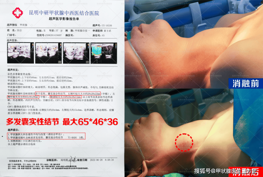 甲减患者的这十大前期信号，看看你中了几个？