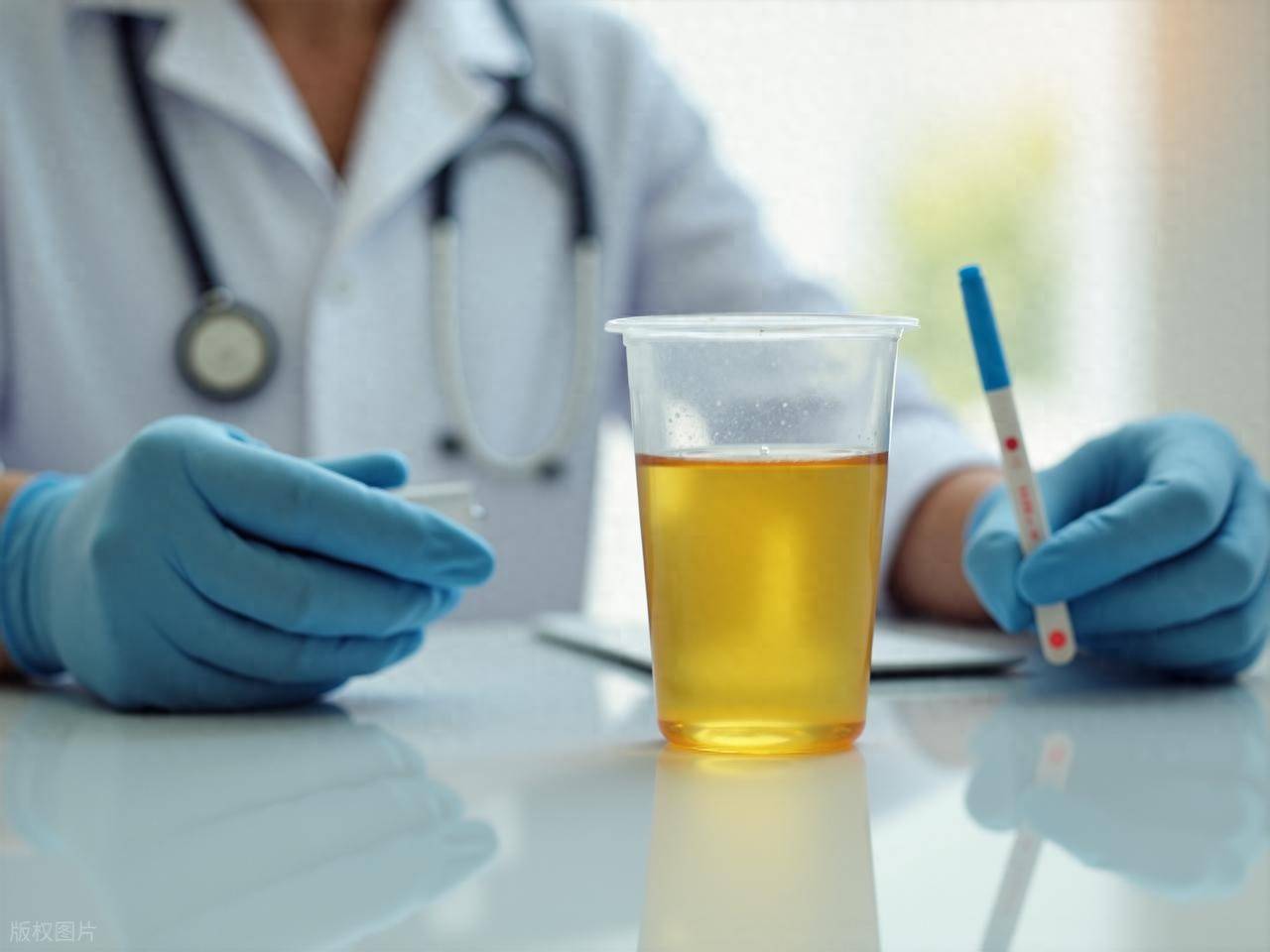 排尿很黄、异味很大？身体向你暗示的5件事，别不当回事！