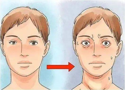 西安甲康甲状腺医生科普：甲亢患者5个典型症状及4项饮食注意