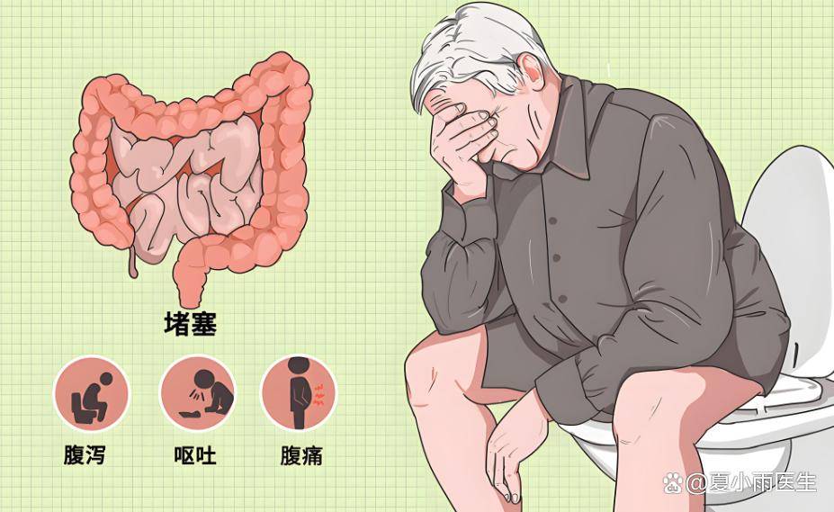脊髓损伤患者便秘的预防与护理：系统化方案与创新技术
