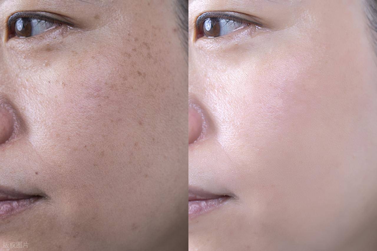 夏炳均中医博士：内外合治祛色斑，上千 “斑长” 重焕肌肤光彩