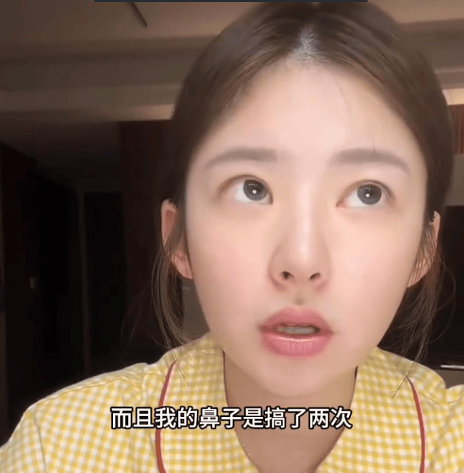 黄一鸣自曝整容整鼻子失败嘴巴歪 称女儿和爷爷奶奶还没见过面