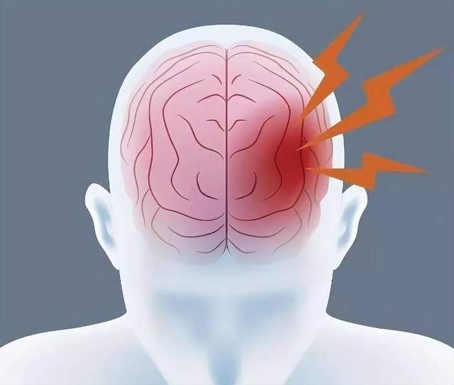 原创            总熬夜？血压也高了？小心脑中风！FAST原则，这些救命信号别忽视