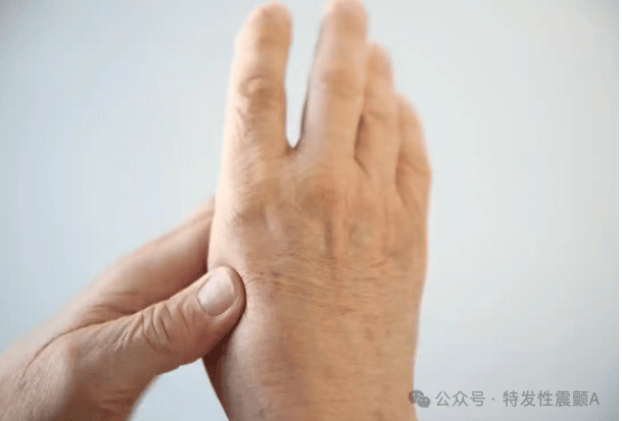 一文读懂特发性震颤：那些关于 “手抖” 的真相