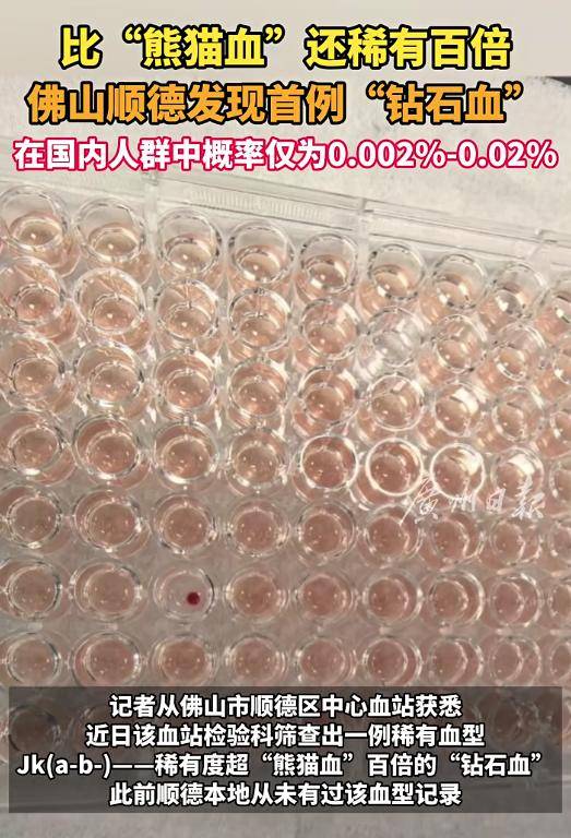首例！广东顺德发现一例“钻石血”