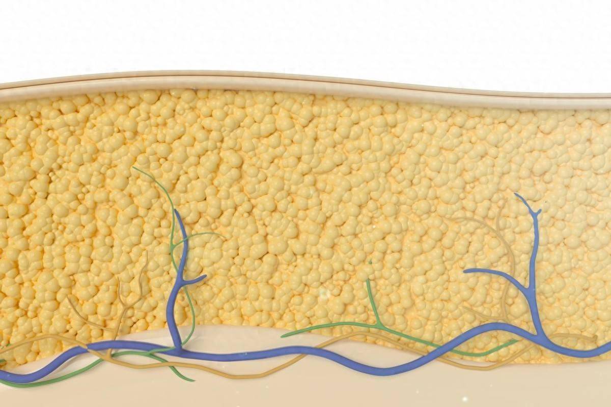 科普|腿肿可能是身体在报警！