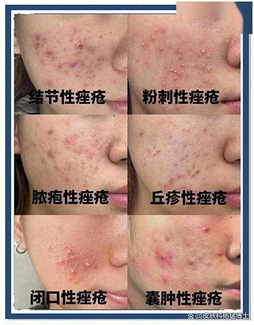 预制菜也许正在毁掉你的皮肤