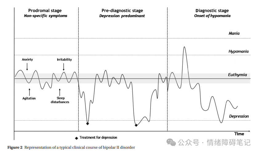 双相II型障碍：最新研究综述